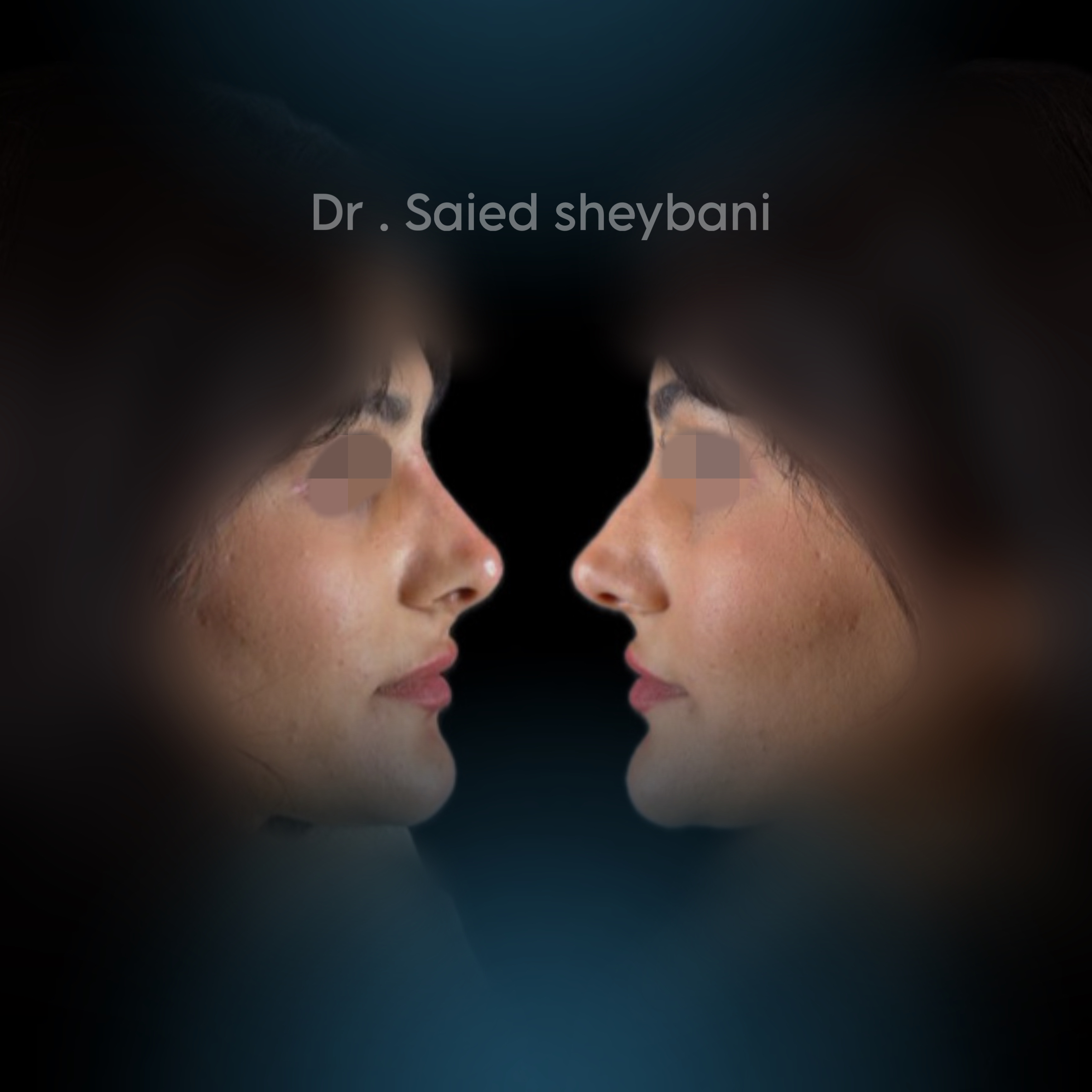 گالری آواتار بینی - تصویر 2