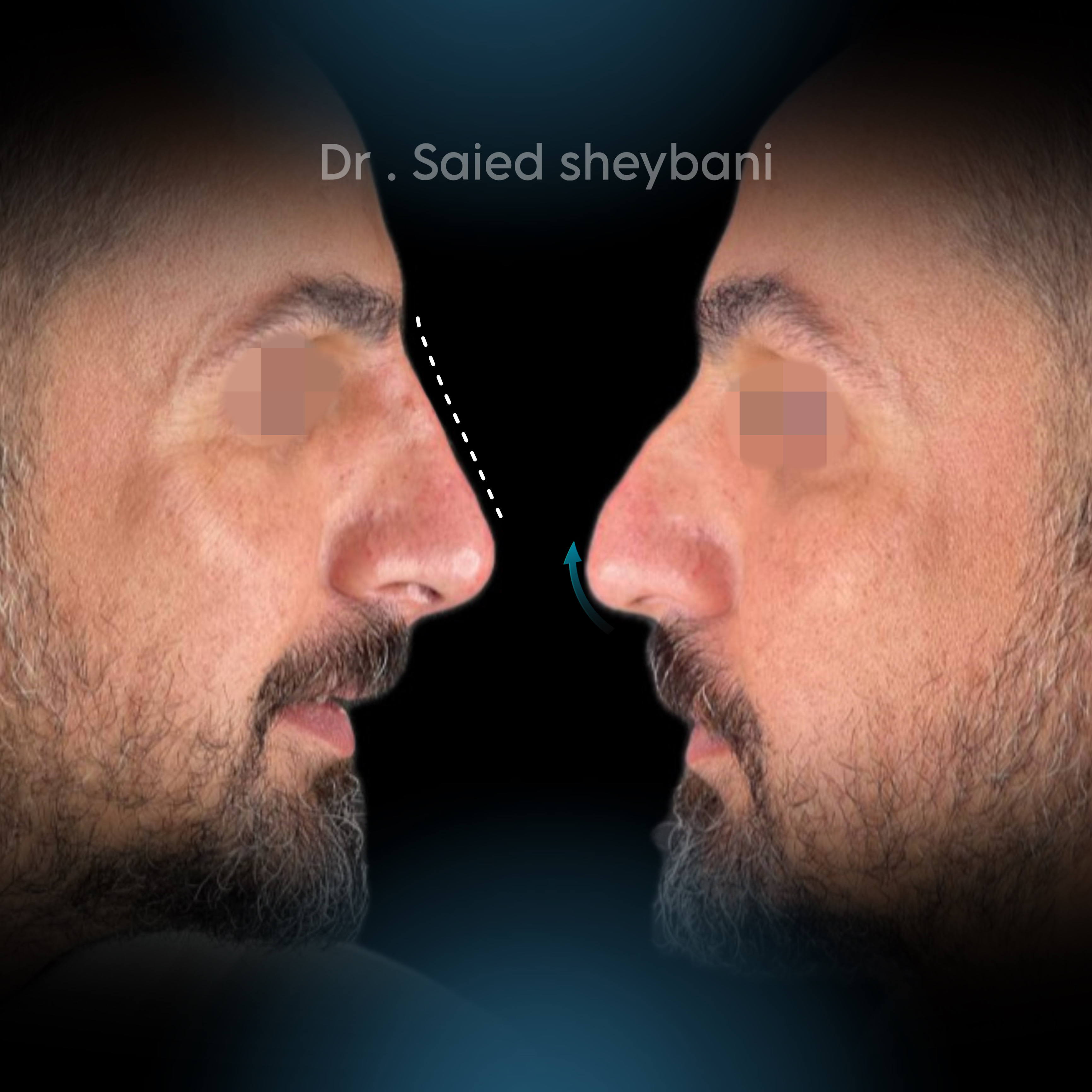 گالری آواتار بینی - تصویر 5