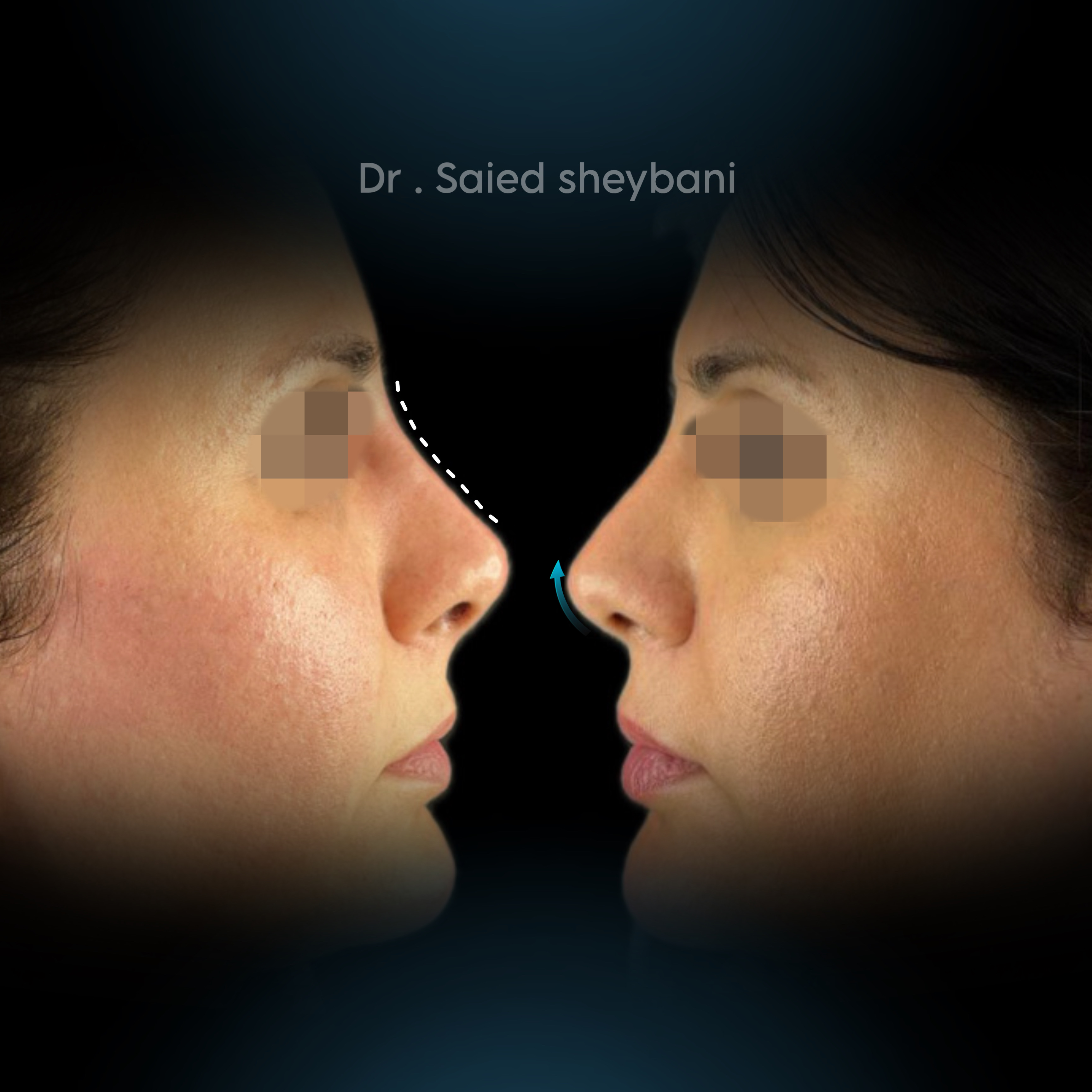 گالری آواتار بینی - تصویر 7