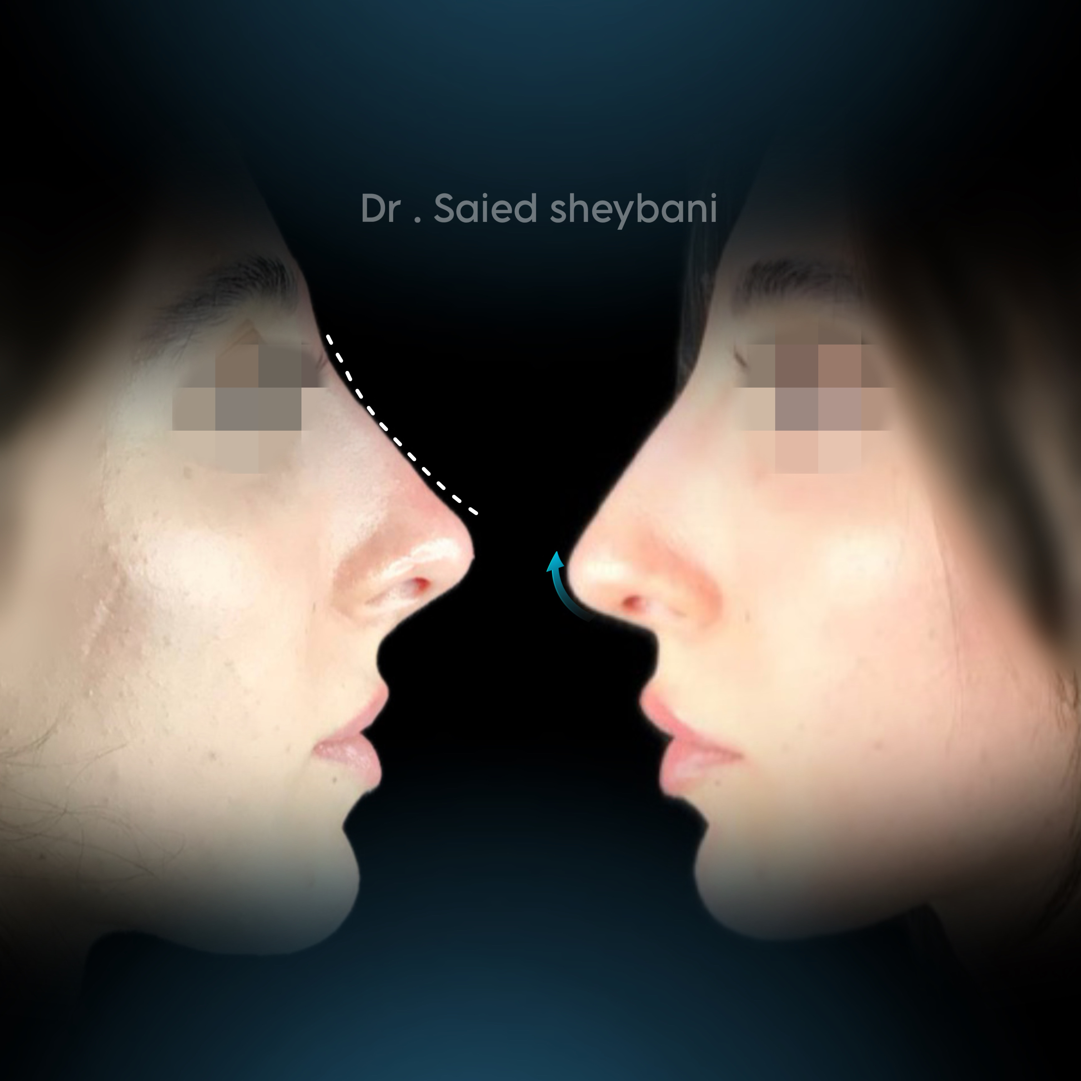 گالری آواتار بینی - تصویر 8