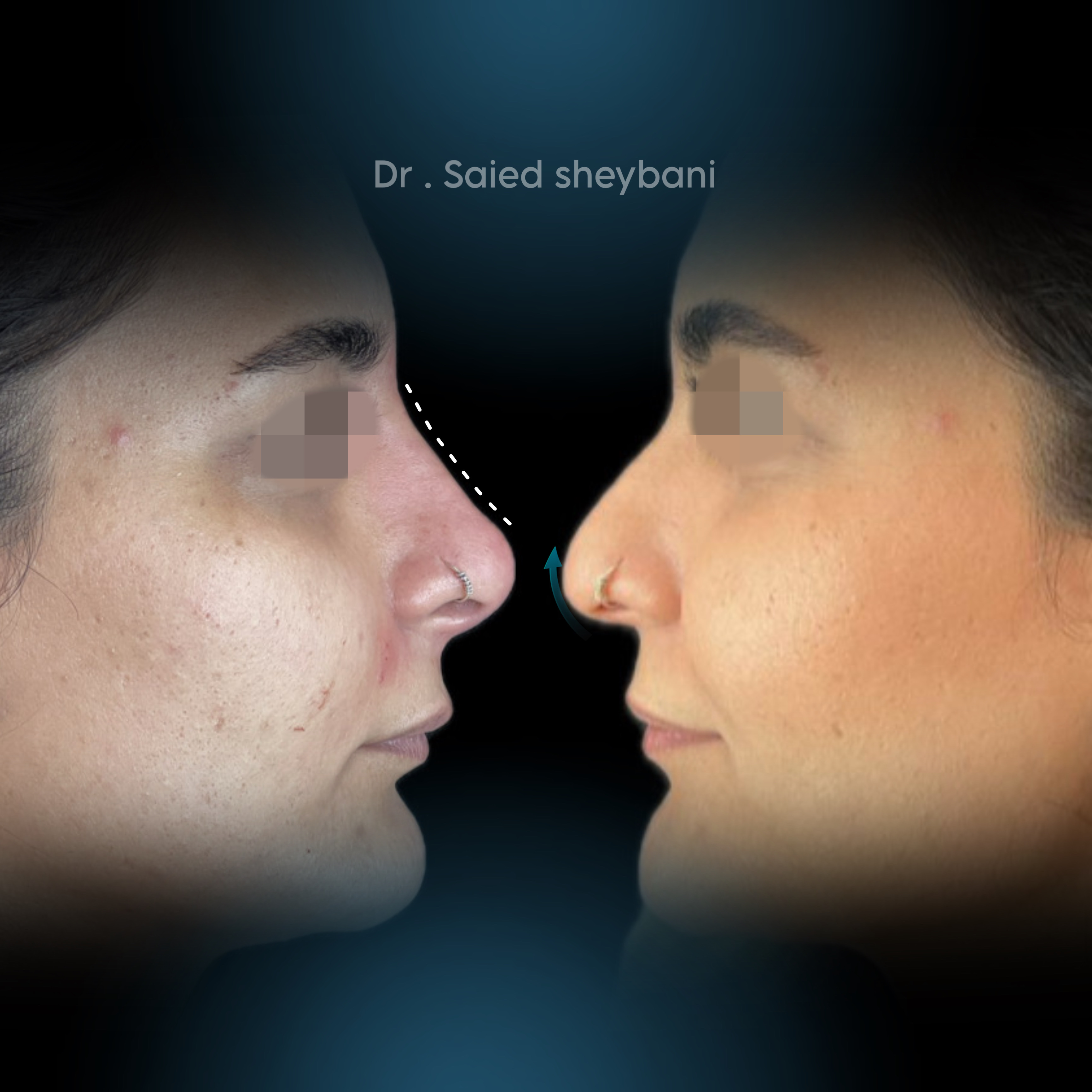 گالری آواتار بینی - تصویر 11