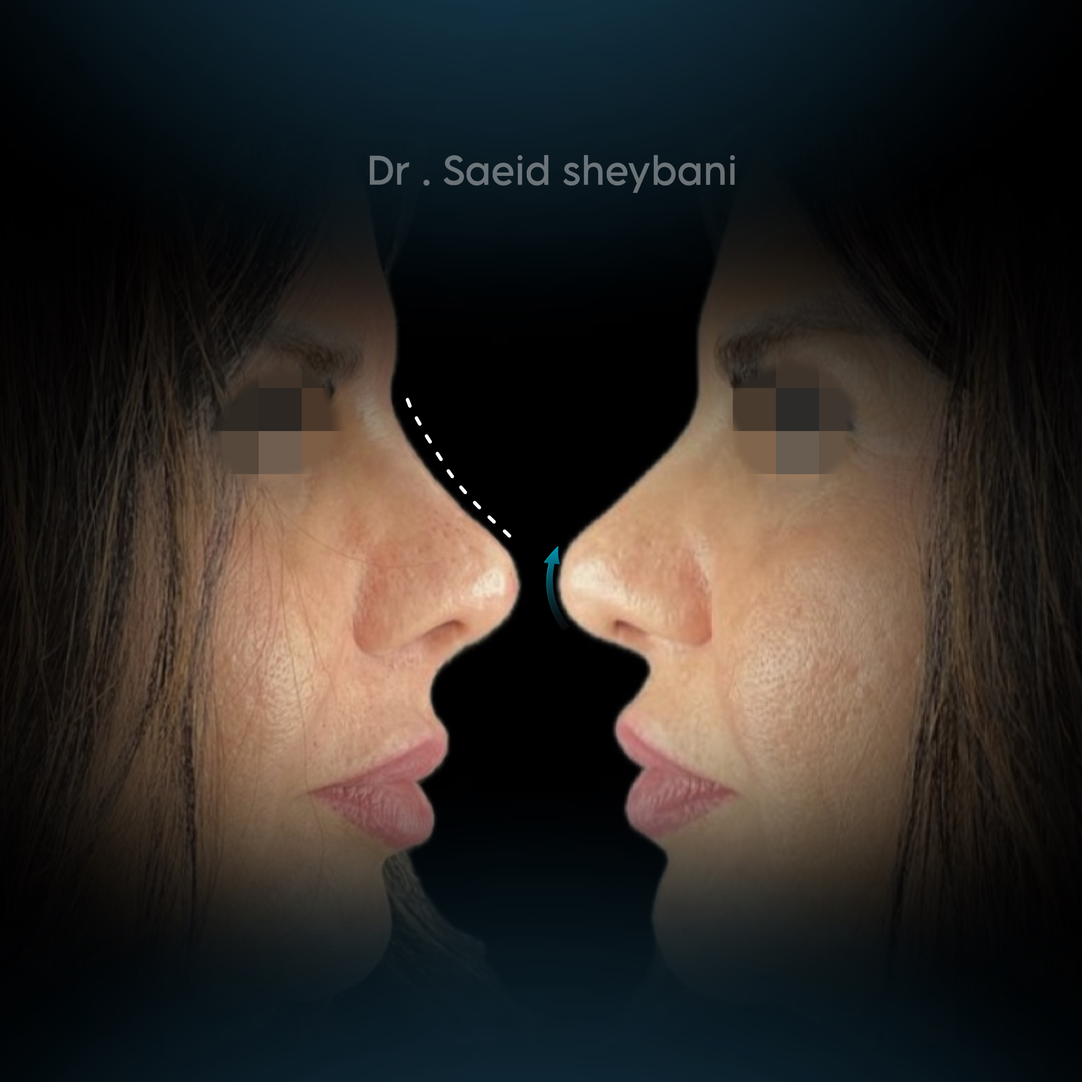 گالری آواتار بینی - تصویر 13