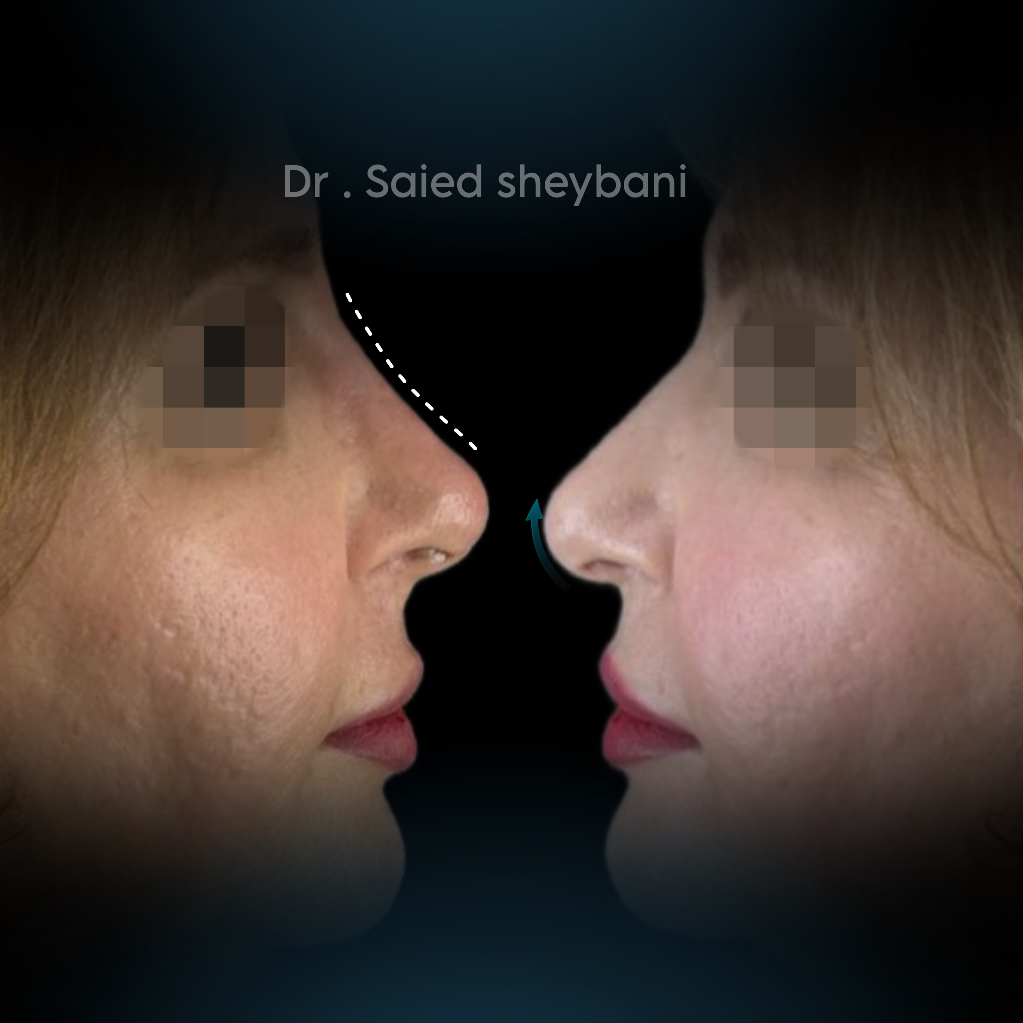 گالری آواتار بینی - تصویر 14