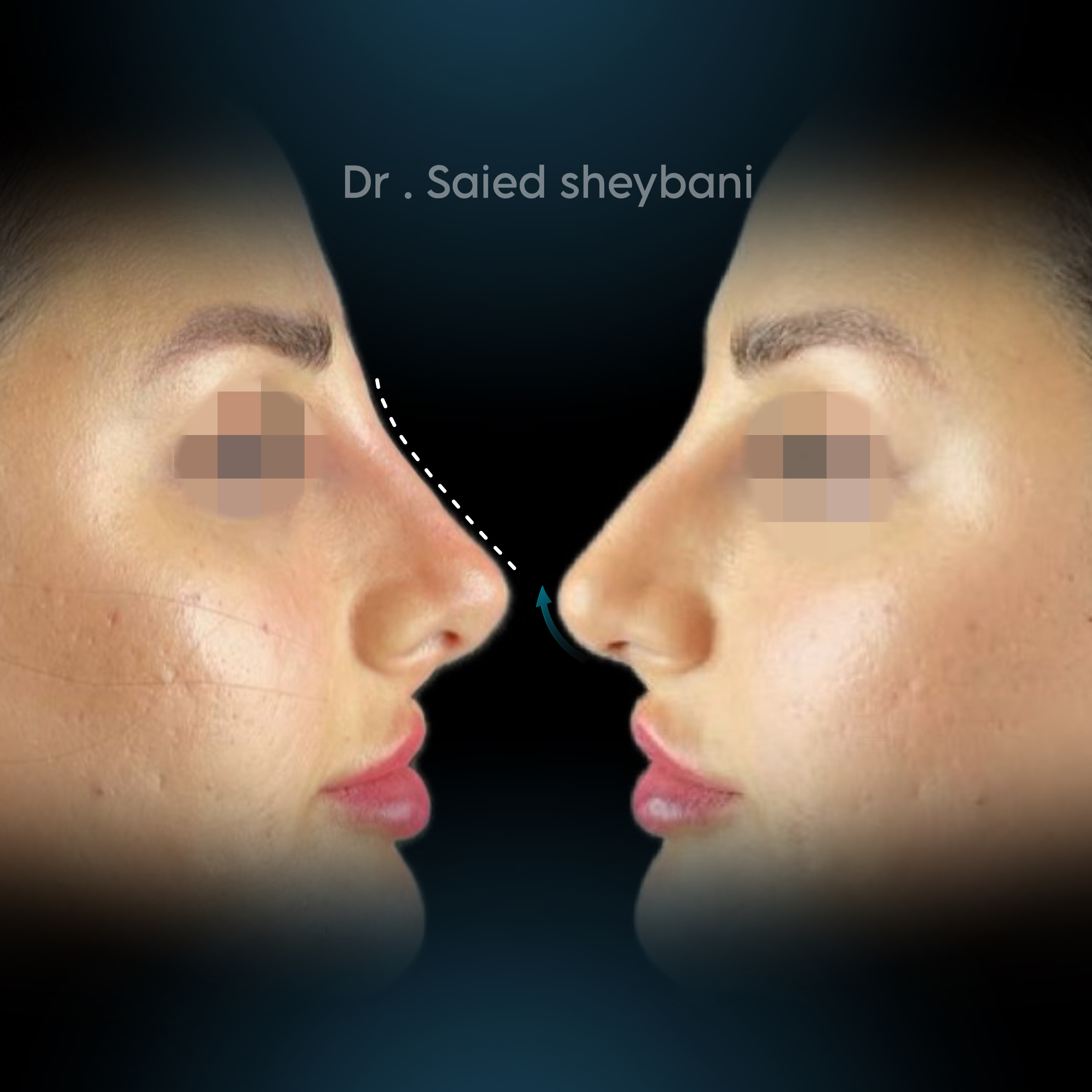 گالری آواتار بینی - تصویر 15