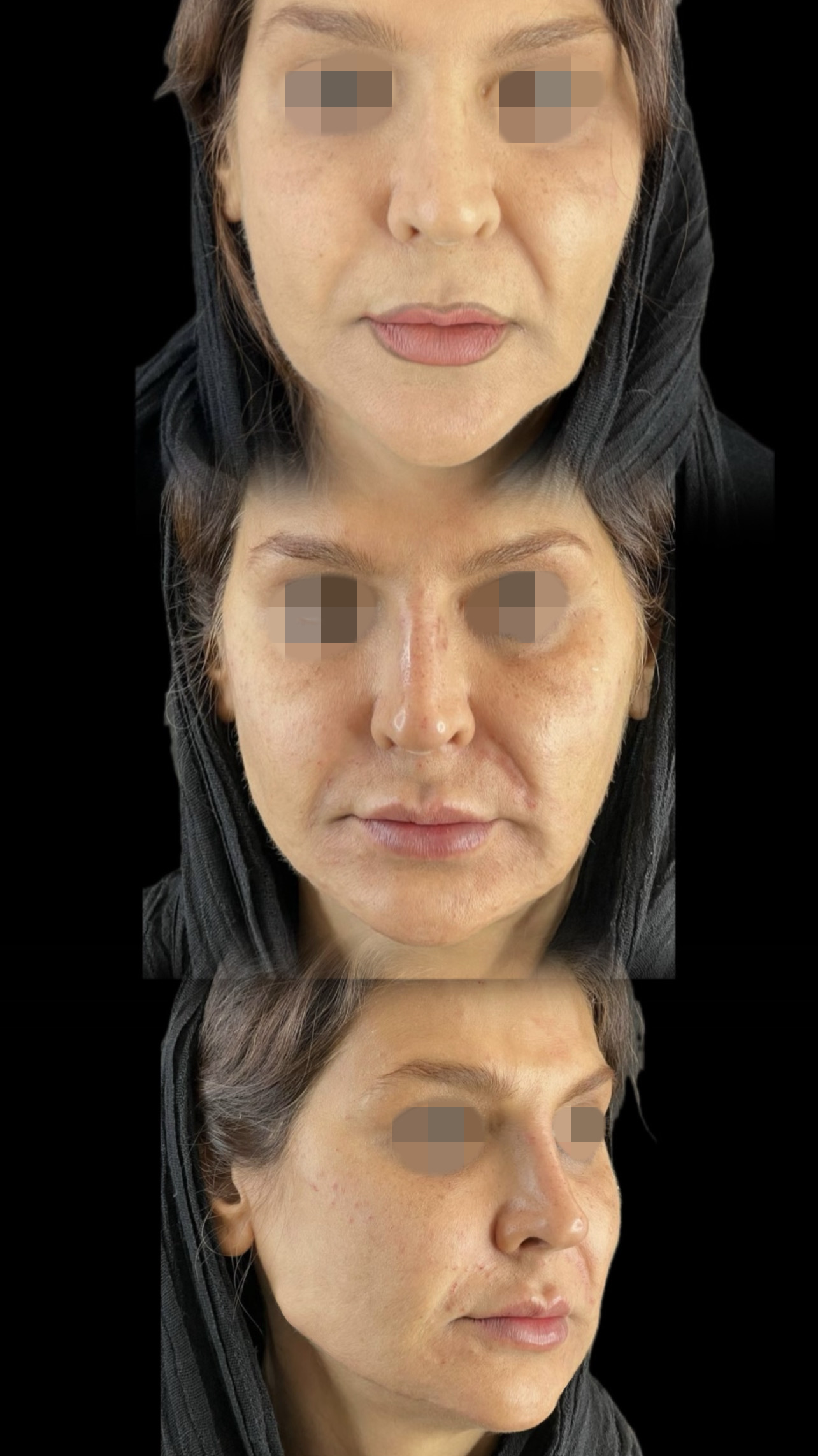 گالری Down Lift - تصویر 1